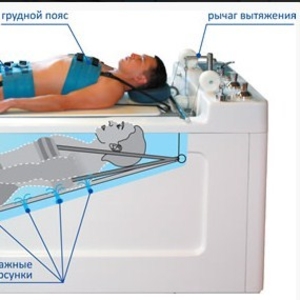 Акватракцион для вытяжения позвоночника
